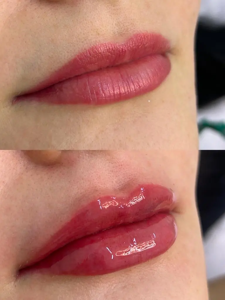 labial 1